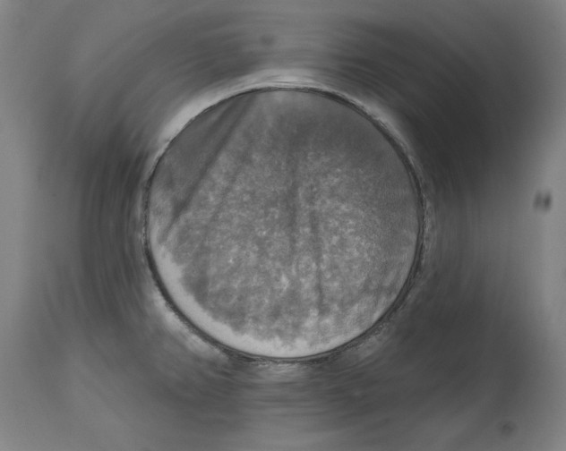 X0000114611382200911171025