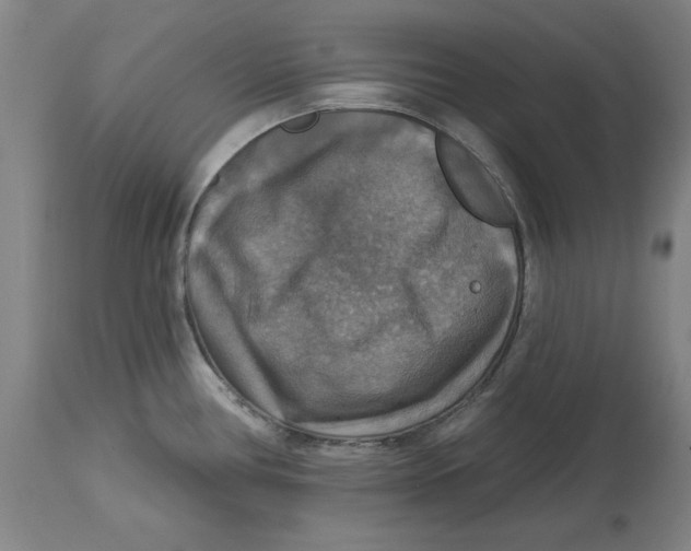 X0000114611386200911171025