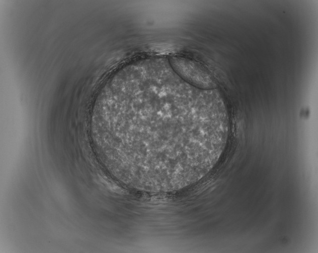 X0000114611393200911171024