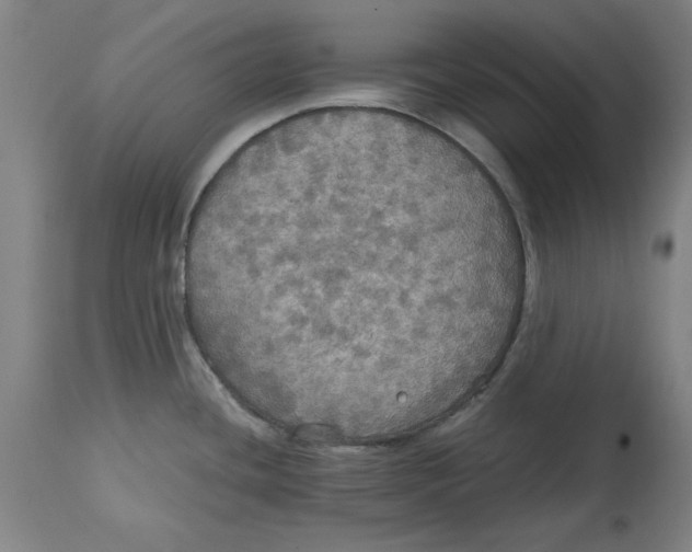 X0000114611436200911171025