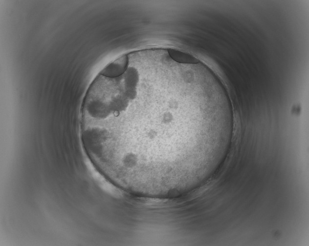 X0000114611439200911171025