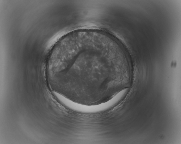 X0000114611455200911171024