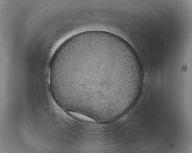 X0000114611510200911171023