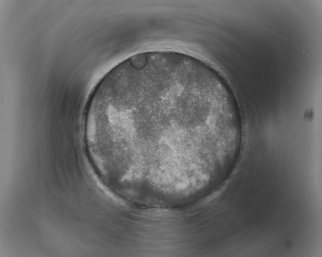 X0000114611517200911171023