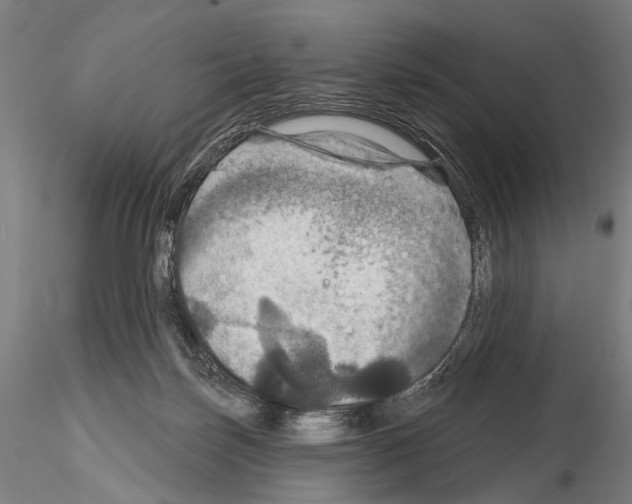 X0000114610171200912010946