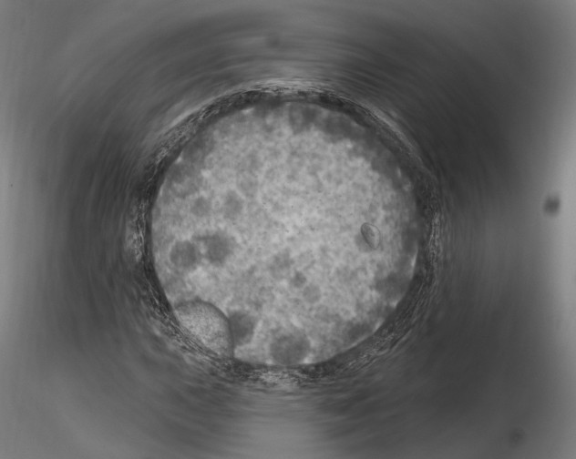 X0000114611015200912010932