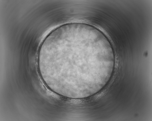 X0000114611094200912010931