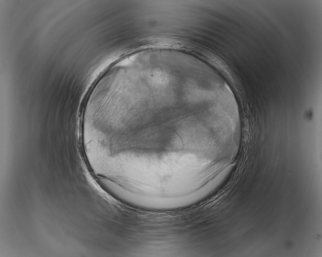 X0000114611095200912010931