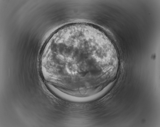 X0000114611279200912010929