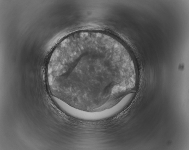 X0000114611455200912010926