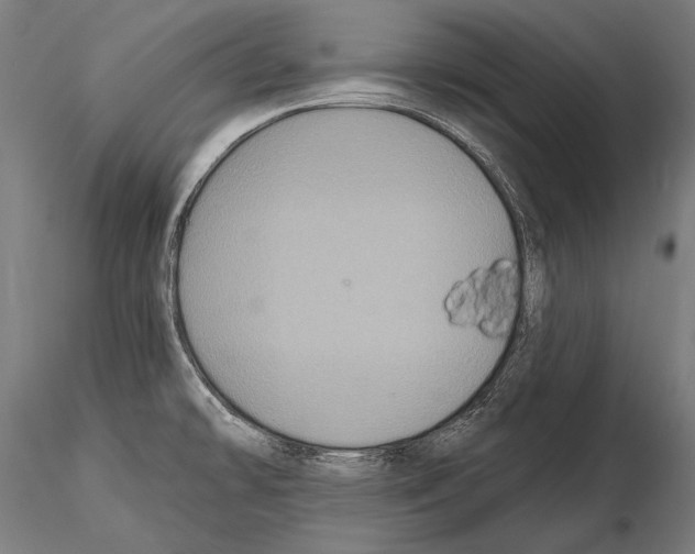 X0000114611478200912010925