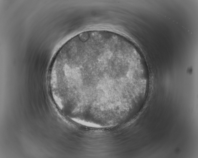 X0000114611517200912010925