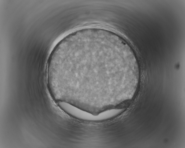 X0000114611522200912010925