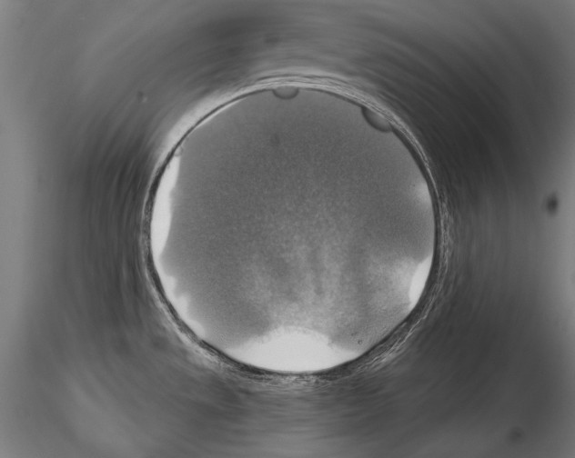 X0000114611533200912010925