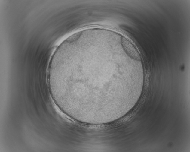 X0000114611535200912010925