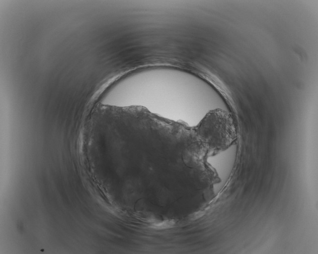 X0000114620155200910201009