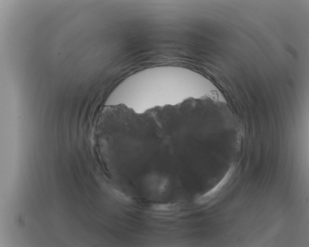 X0000114620187200910201009