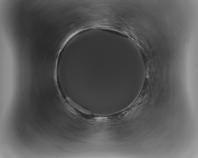 X0000114620052200910201140