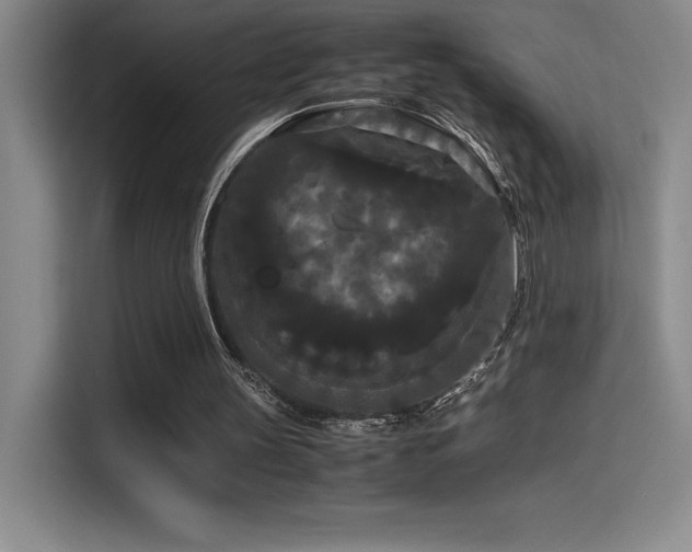 X0000114620147200910201139