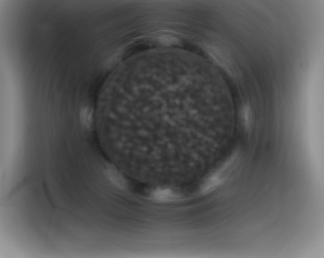 X0000114620177200910201140