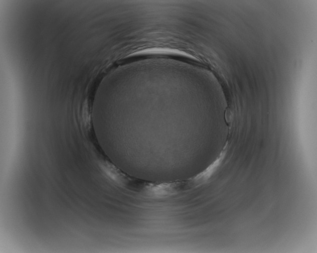 X0000114620186200910201140