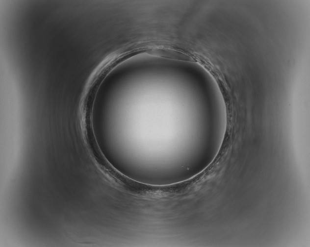 X0000114620197200910201139