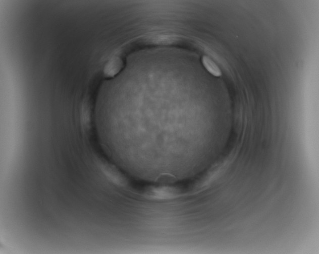 X0000114620268200910201138