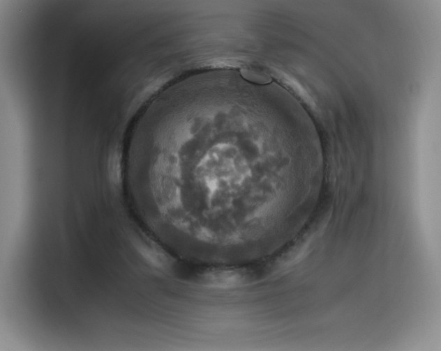 X0000114620299200910201138