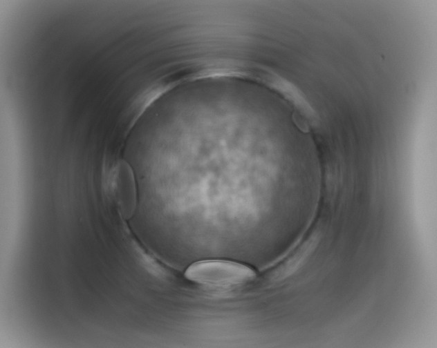 X0000114621185200910201126