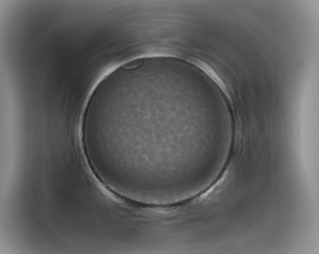X0000114621197200910201126