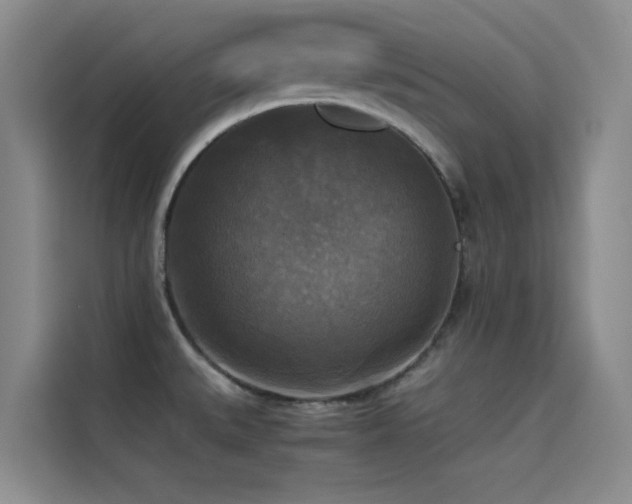 X0000114621527200910201122