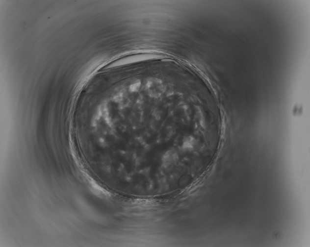 X0000114620145200911101222