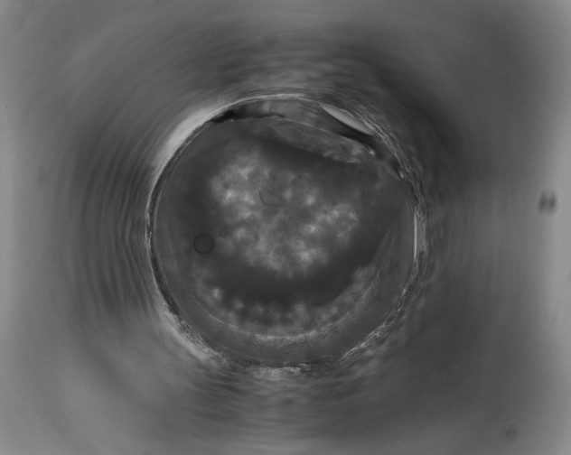 X0000114620147200911101222