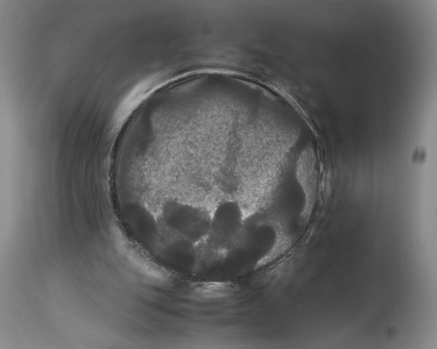 X0000114620151200911101222
