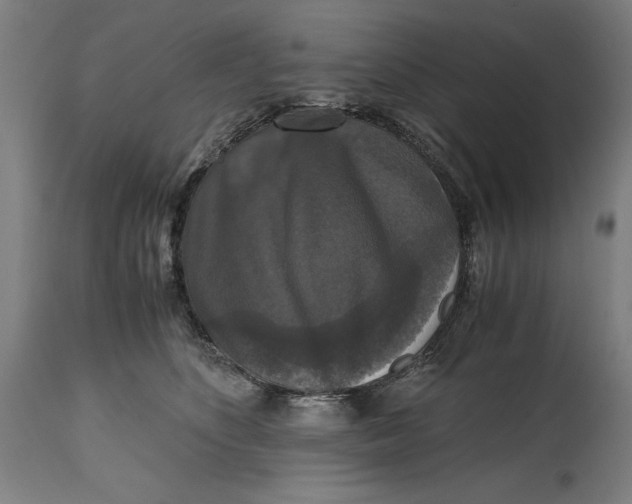 X0000114620516200911101217