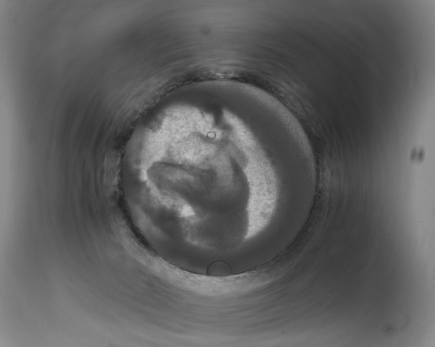 X0000114620030200911171108