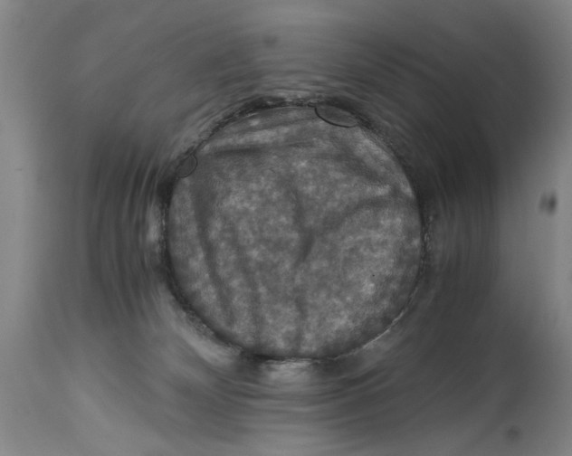 X0000114620132200911171106