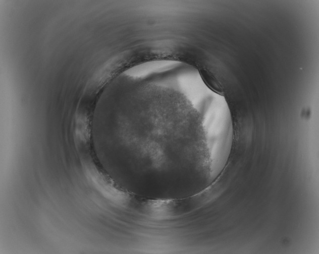 X0000114620136200911171106