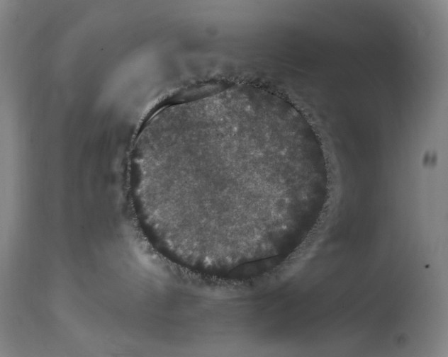 X0000114620144200911171106