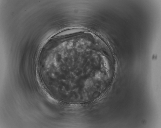 X0000114620145200911171105