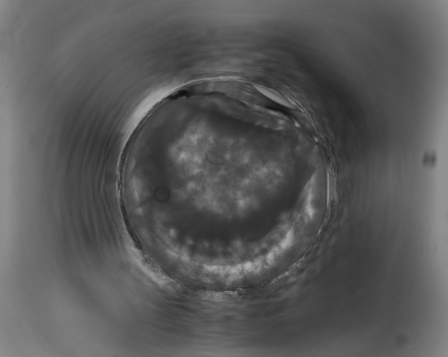 X0000114620147200911171105