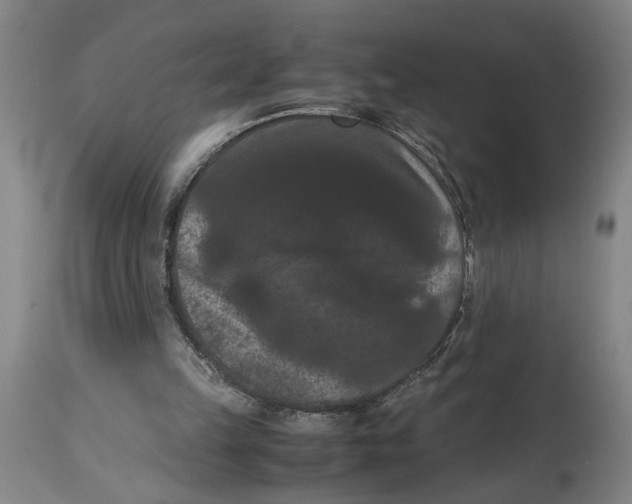 X0000114620149200911171105