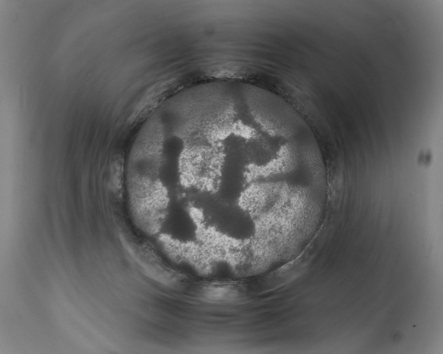 X0000114620175200911171106