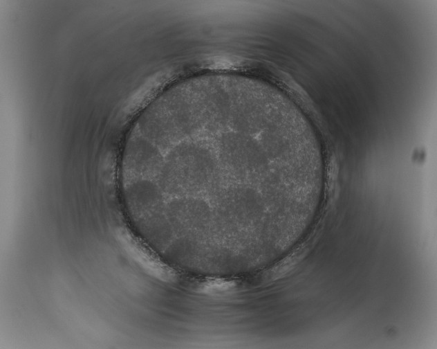 X0000114620257200911171104