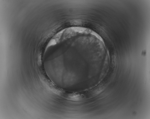 X0000114620267200911171104