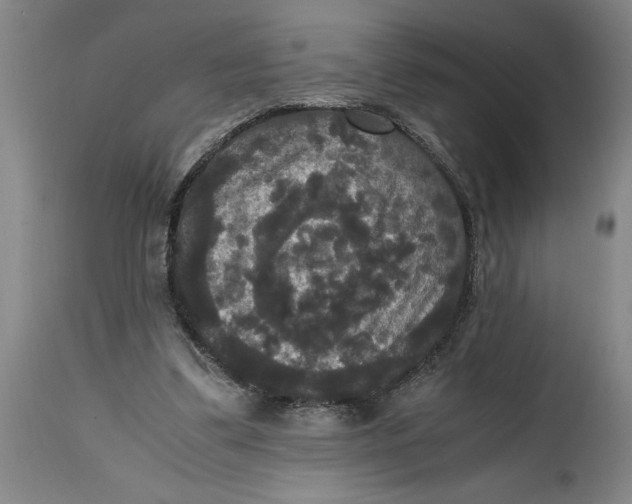 X0000114620299200911171104