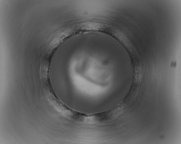 X0000114620309200911171103