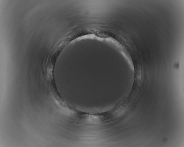 X0000114620332200911171103