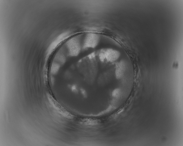 X0000114620343200911171102