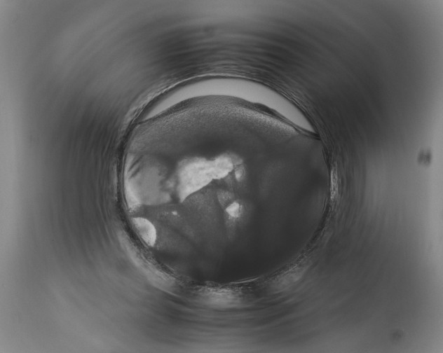 X0000114620349200911171102